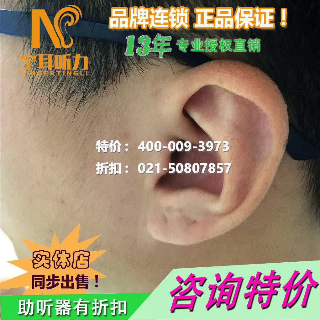 上海靜安西門(mén)子助聽(tīng)器驗(yàn)配中心