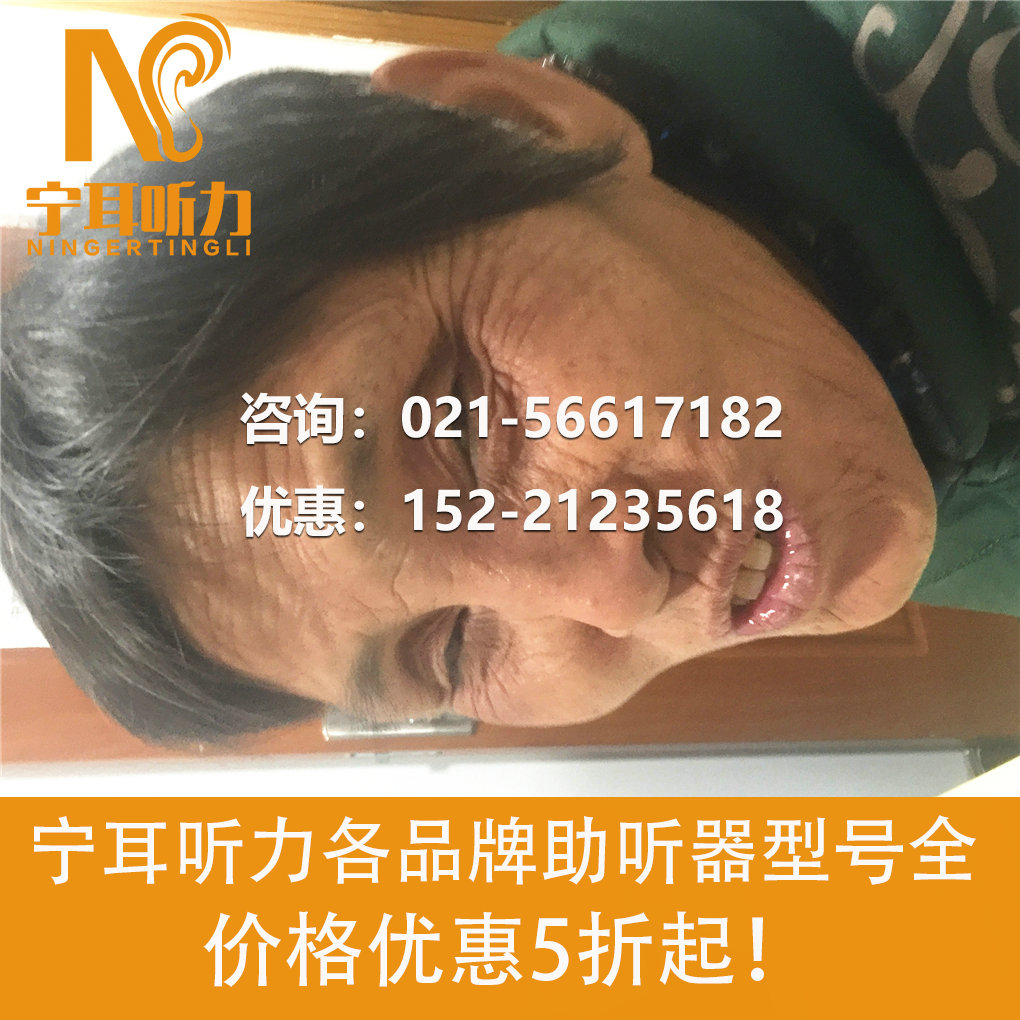 上海徐匯峰力倫巴夢(mèng)Virto Q50助聽(tīng)器專(zhuān)賣(mài)店
