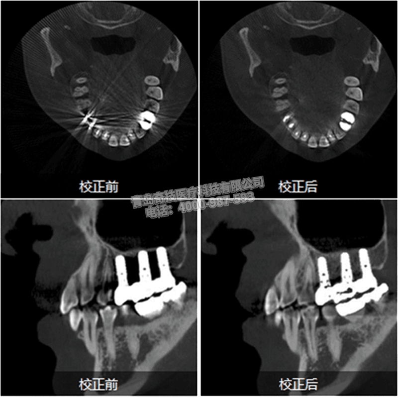 ؿǻCBCT ȫC(j)LARGEV(gu)a(chn)ҕa(chn)ƷBHiRes3D