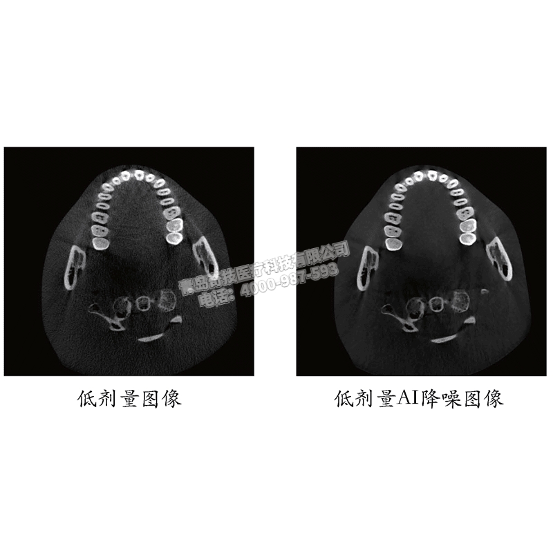 山西口腔CBCT 口腔全景機(jī)博恩登特產(chǎn)品介紹